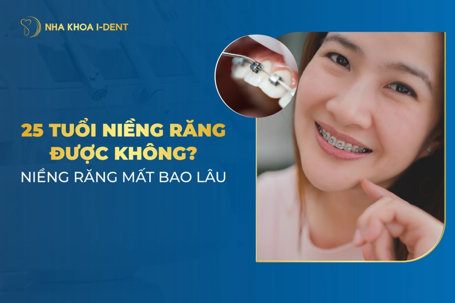 25 tuổi niềng răng được không? Mất bao lâu?