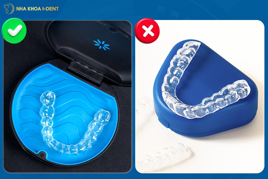 Khay niềng chất lượng sẽ rút ngắn thời gian chỉnh nha