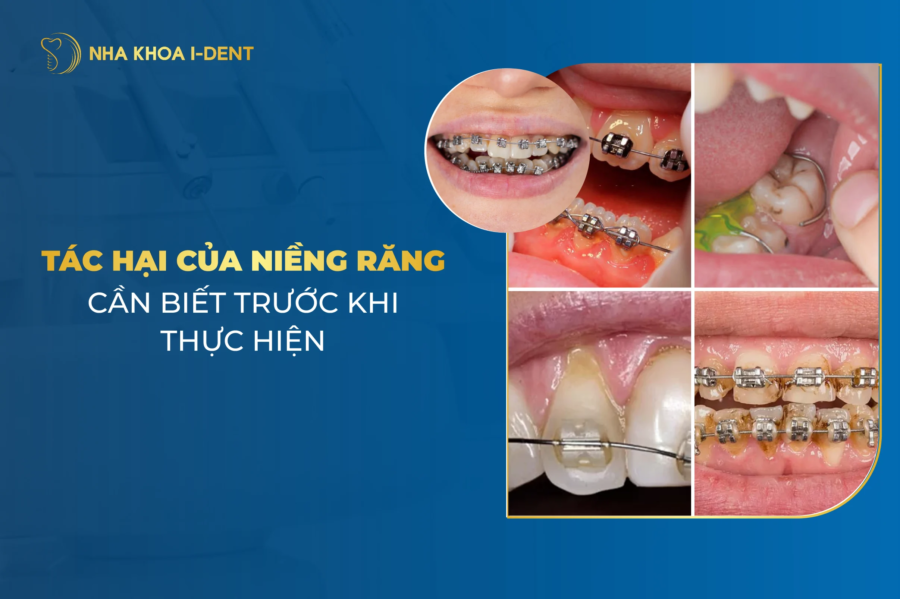 Tác Hại Của Niềng Năng