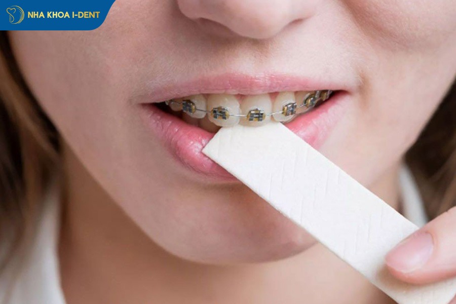 Ăn đồ quá dai là nguyên nhân gây ê buốt.