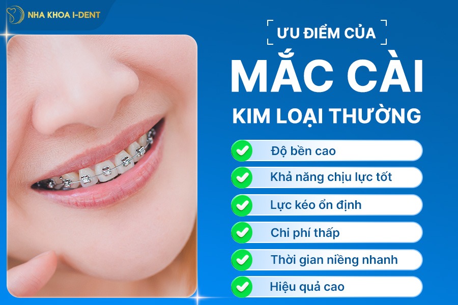 mắc cài kim loại thường và tự buộc