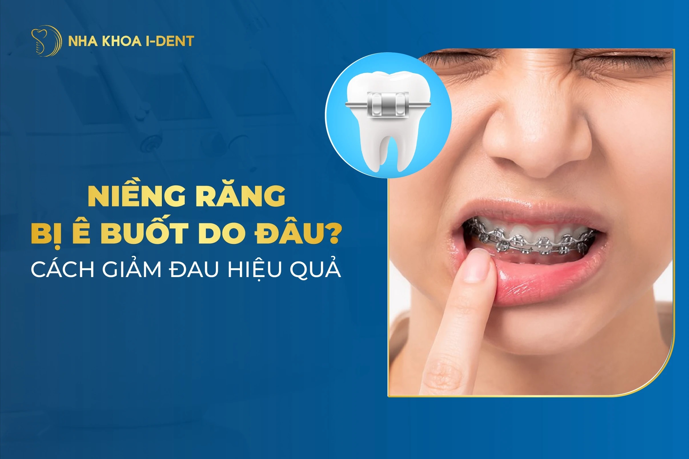 Niềng Răng Bị Ê Buốt Do Đâu? Cách Giảm Đau Hiệu Quả