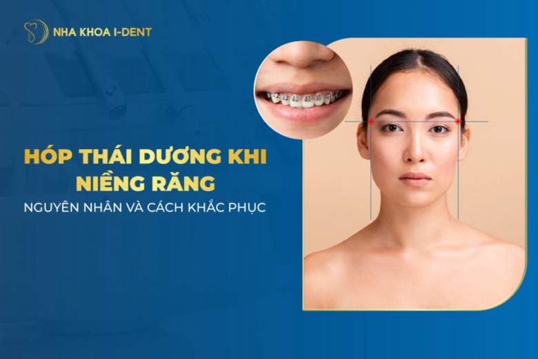 Nguyên nhân niềng răng hóp thái dương? Cách khắc phục