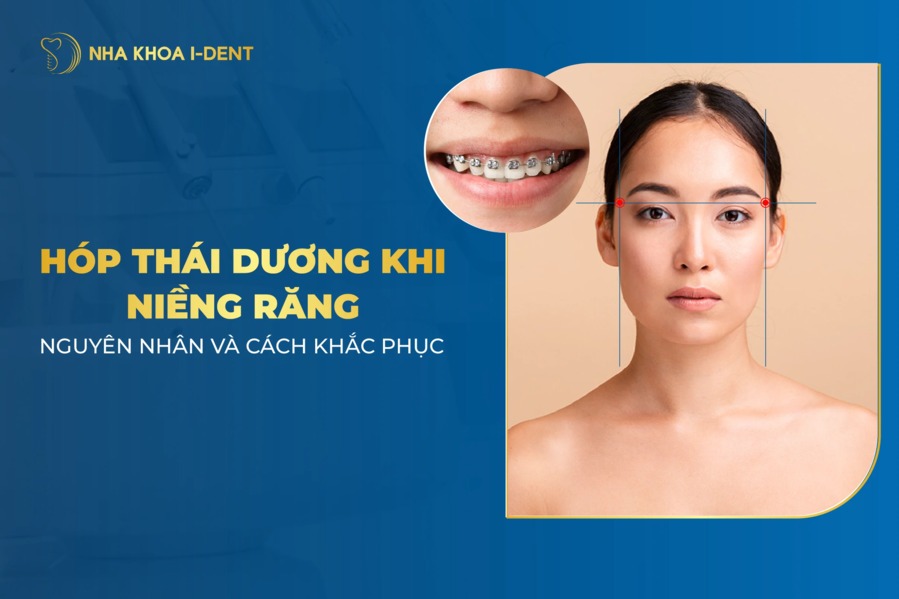 Nguyên nhân niềng răng hóp thái dương? Cách khắc phục