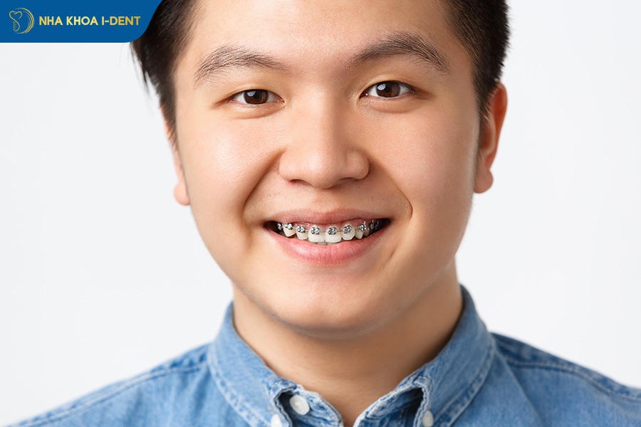 niềng răng có bị yếu răng không