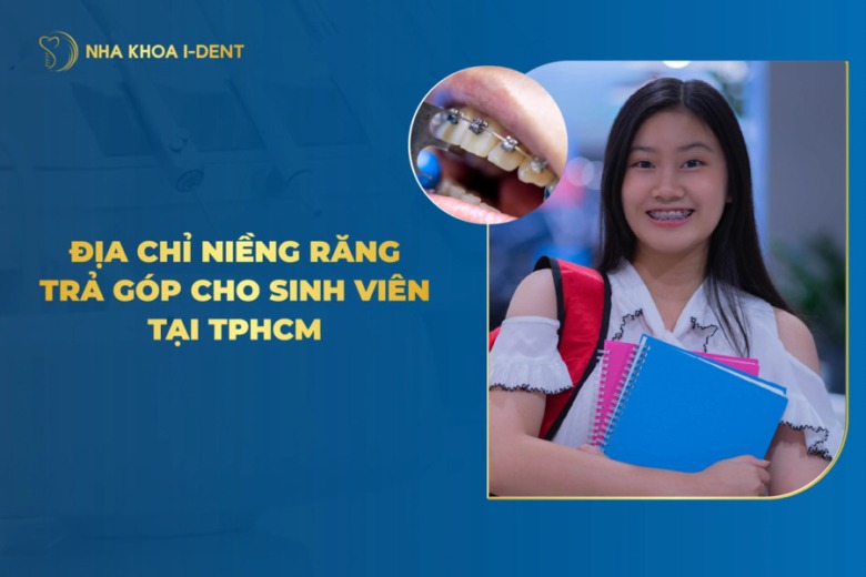 Top 10 địa chỉ niềng răng trả góp cho sinh viên tại TPHCM