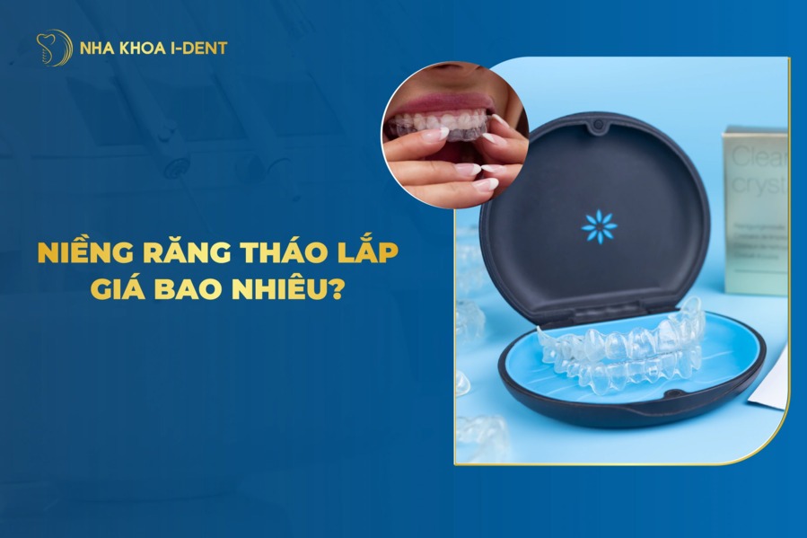 Giá niềng răng tháo lắp bao nhiêu tiền?