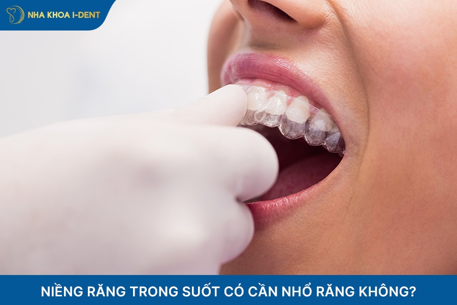 niềng răng trong suốt có cần nhổ răng không