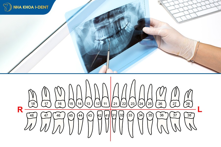 phác đồ niềng răng