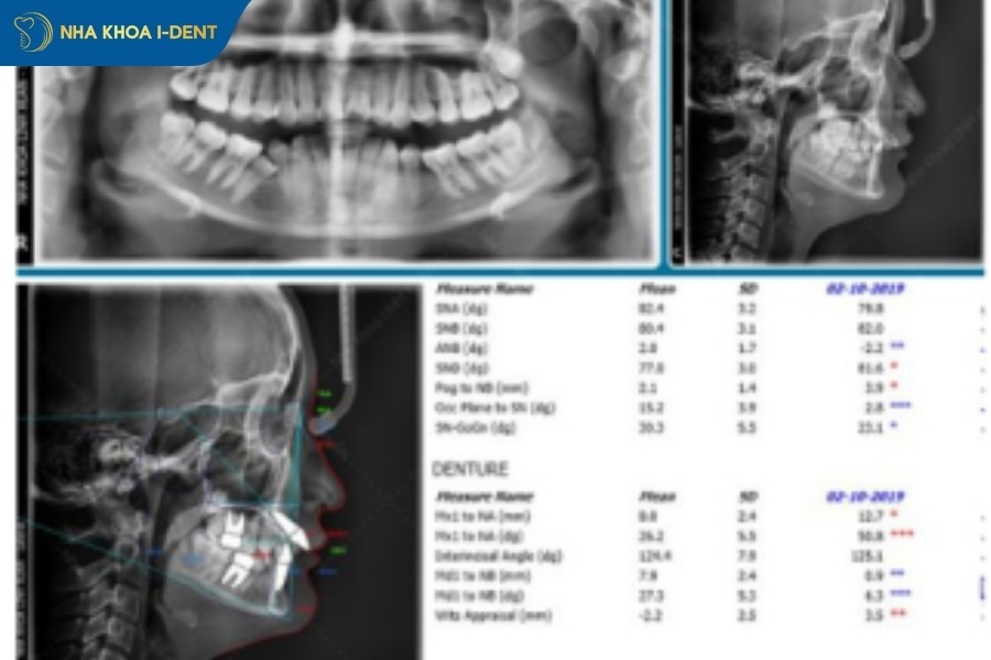 Thu thập dữ liệu và phân tích hình ảnh số