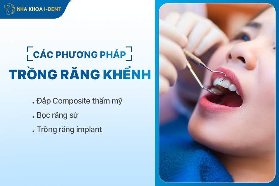 trồng răng khểnh