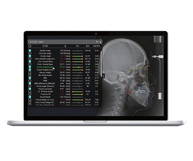Cbct Guided Mini Screw Technology
