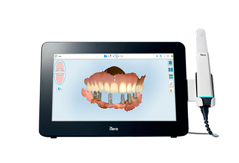 Itero Multi Direct Capture Technology