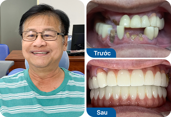 Chú Phan Chí Quyền