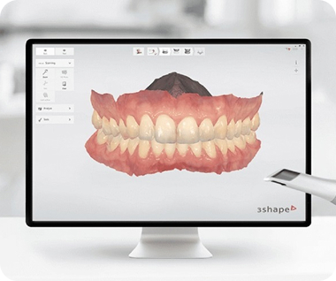 3D Dental Scanning Technology