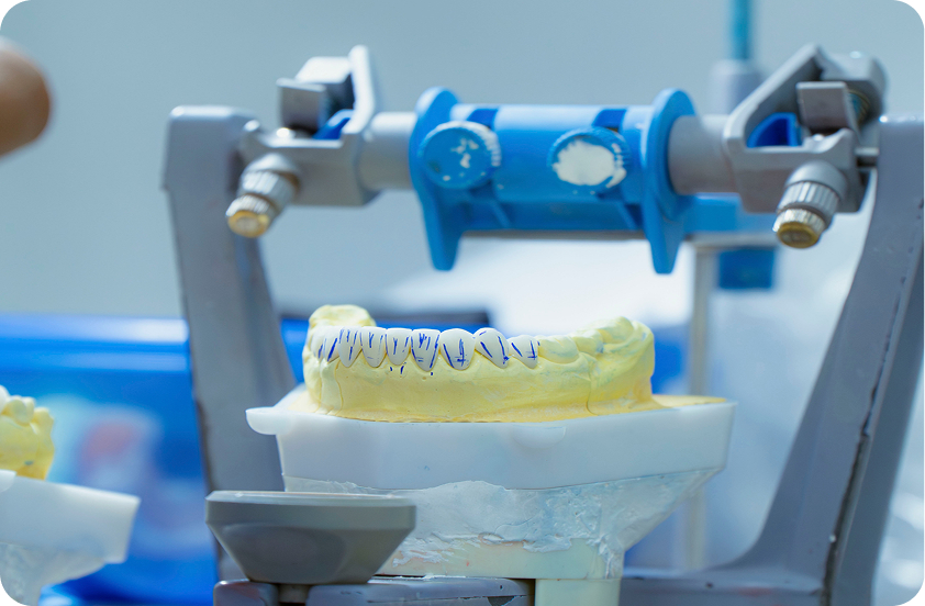 In House Dental Laboratory