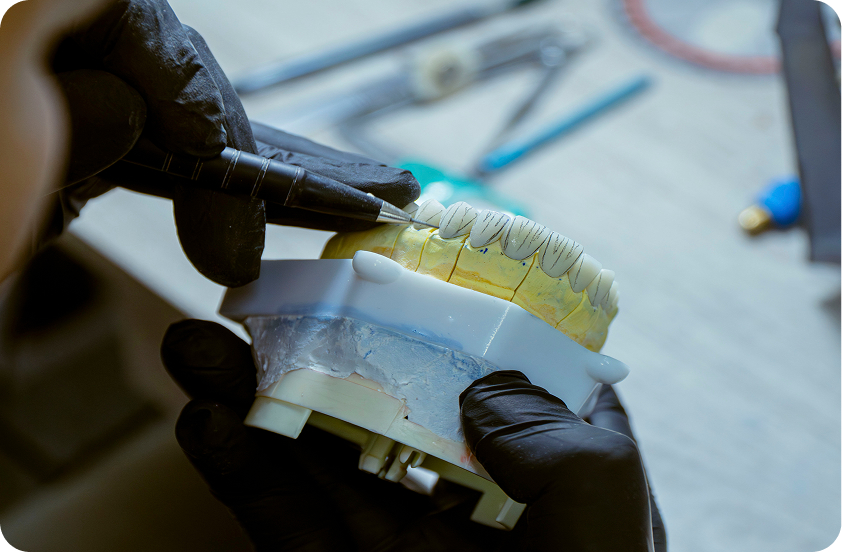 In House Dental Laboratory