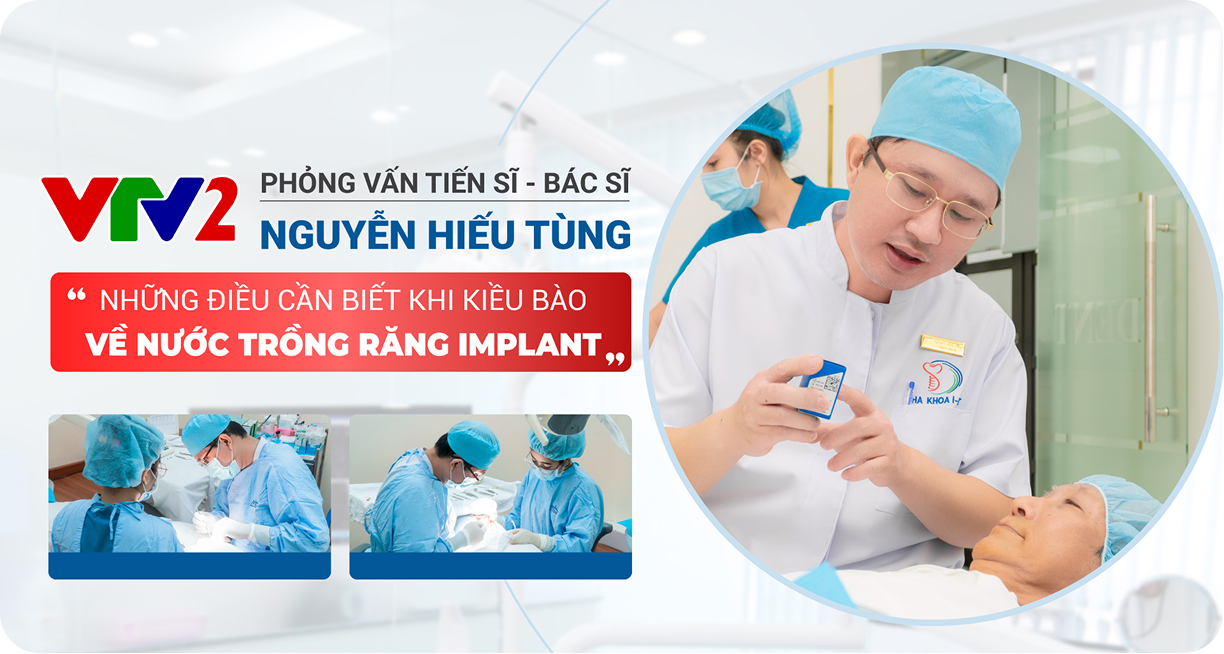 full dental implants