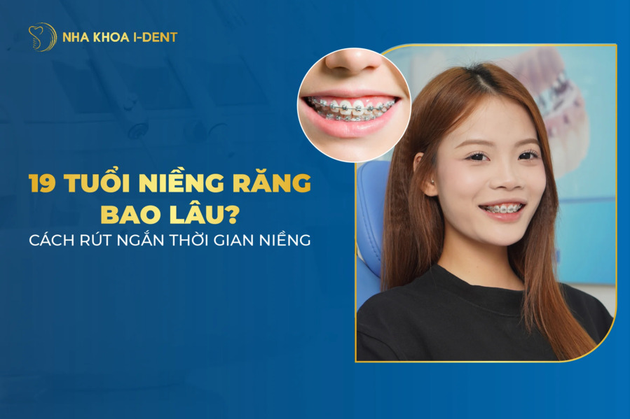 19 tuổi niềng răng bao lâu