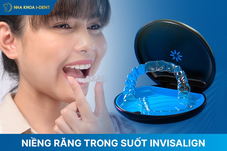 các loại niềng răng trong suốt phổ biến