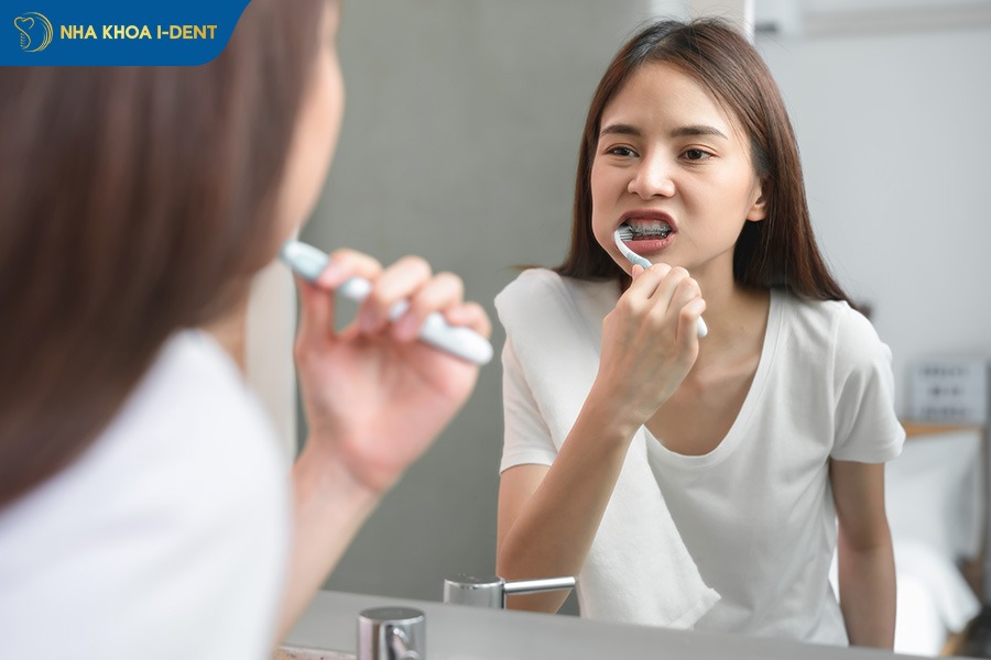 các loại niềng răng