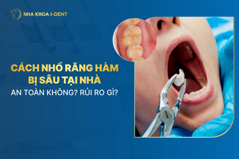 Cách nhổ răng hàm bị sâu tại nhà liệu có an toàn?