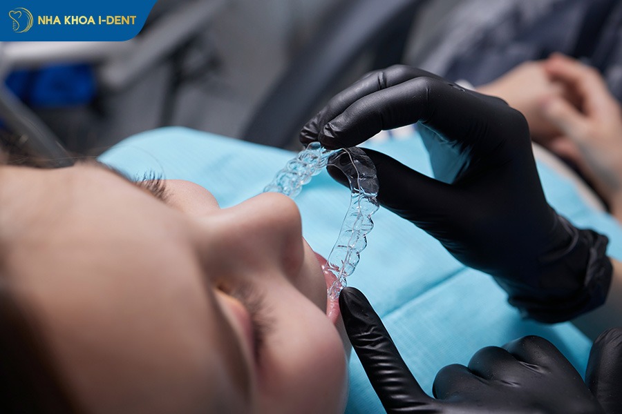 có mấy loại niềng răng trong suốt