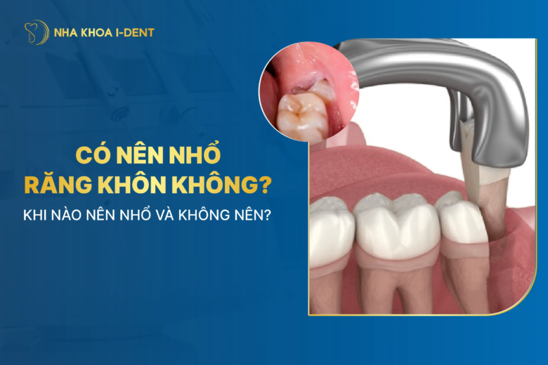 Có nên nhổ răng khôn không? Khi nào nên nhổ và không nên?