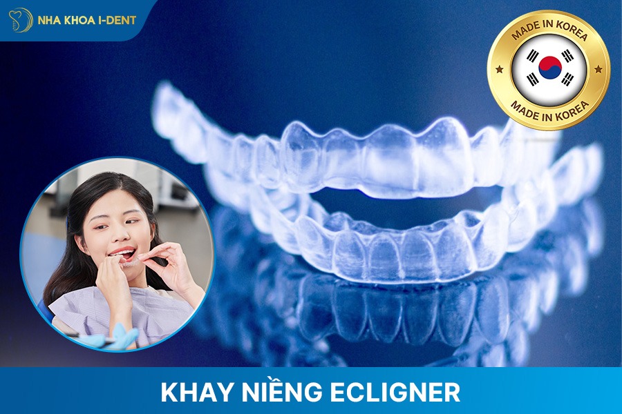 loại niềng răng trong suốt