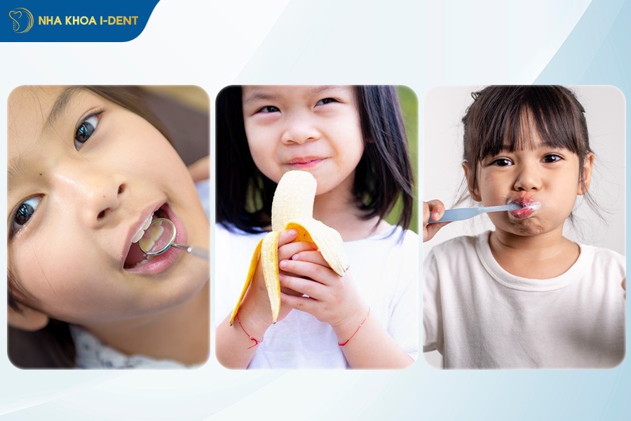 Lưu ý khi niềng răng cho trẻ 7 tuổi