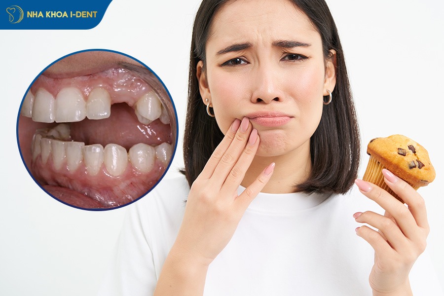 mất răng số 3 hàm dưới