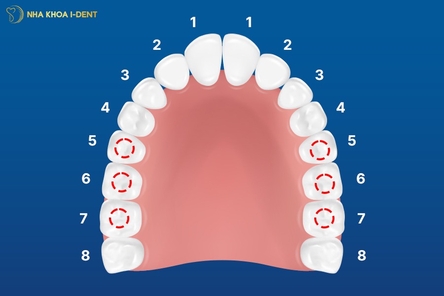 mất răng số 5 hàm dưới có sao không