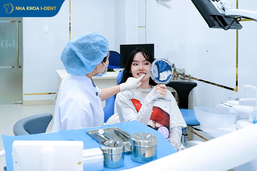 nên niềng răng loại nào