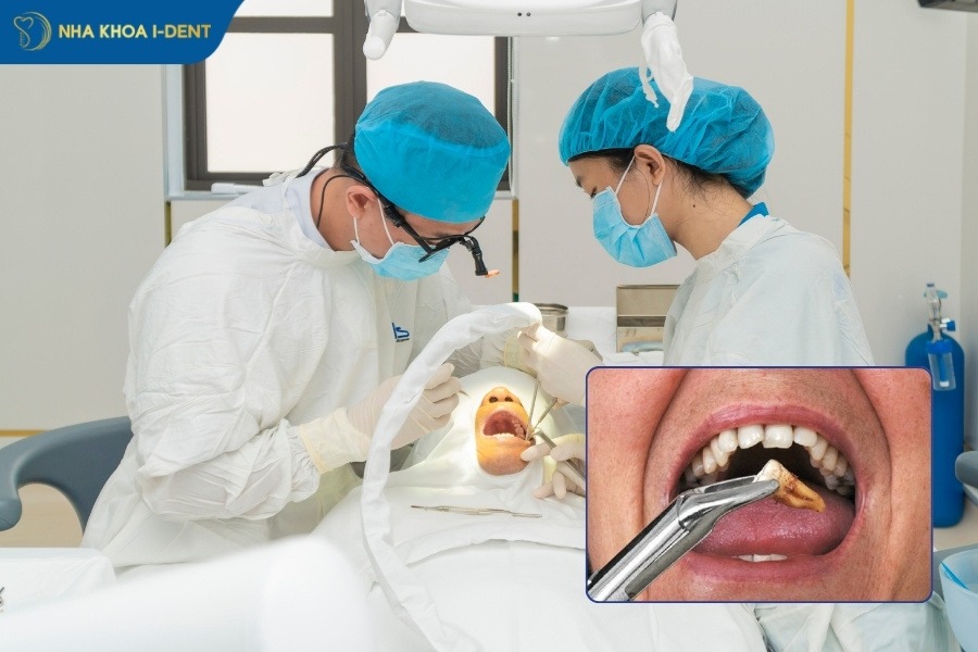 nhổ răng đau không