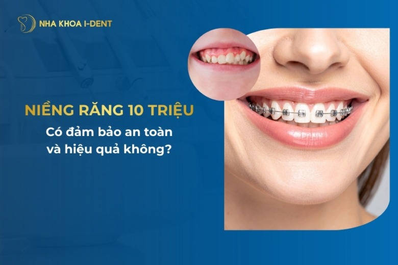 Niềng răng 10 triệu có đảm bảo an toàn và hiệu quả không?