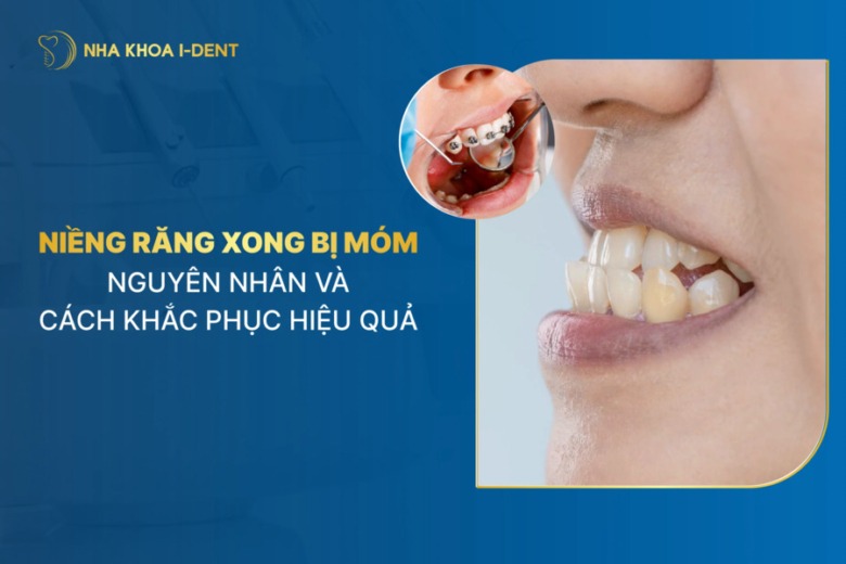 Nguyên nhân gây niềng răng bị móm là gì? Cách khắc phục