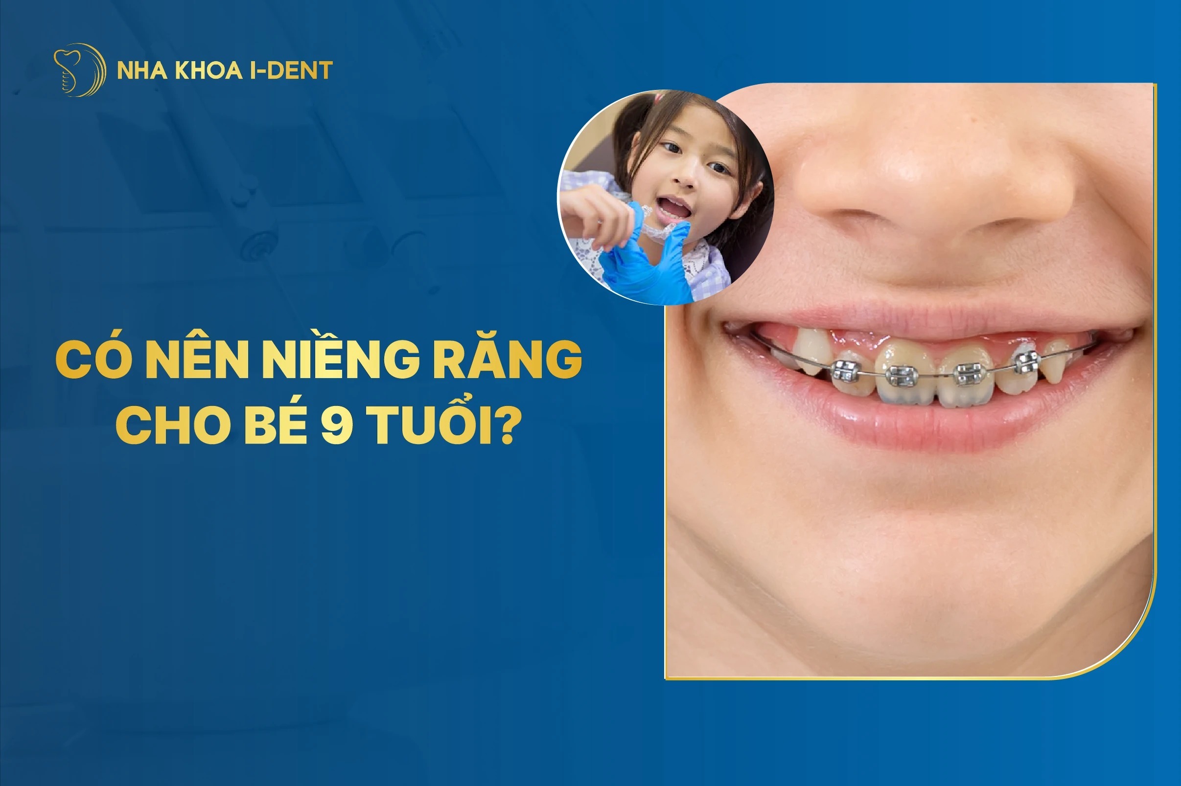 Nên niềng răng cho trẻ 9 tuổi không? Độ tuổi và Phương pháp