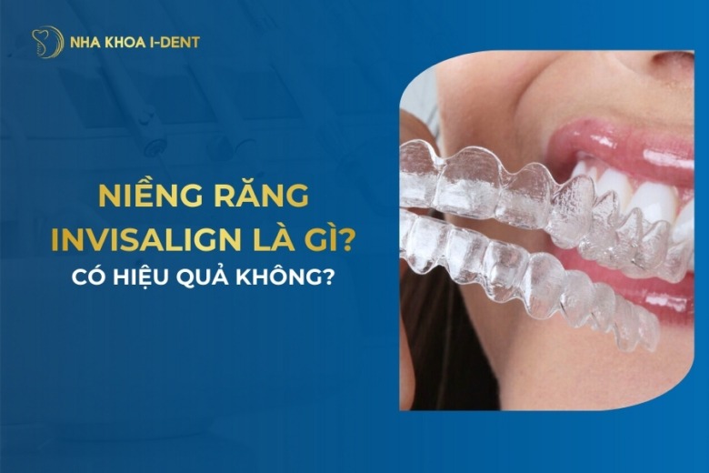 Niềng Răng Invisalign Là Gì? Có Hiệu Quả? Ưu Điểm