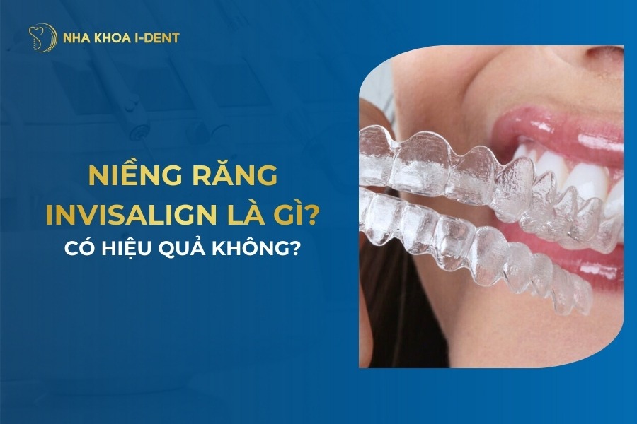 Niềng Răng Invisalign Là Gì? Có Hiệu Quả? Ưu Điểm