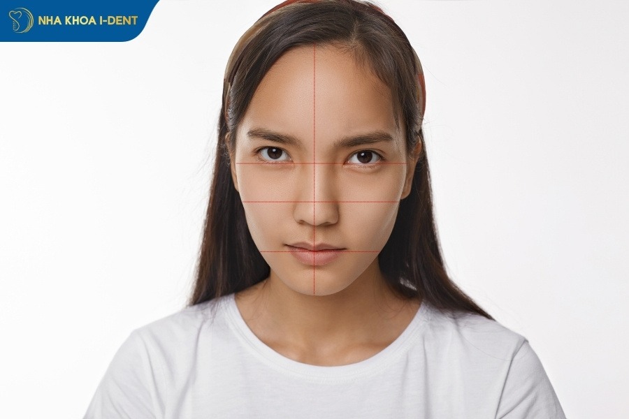 niềng răng trả góp