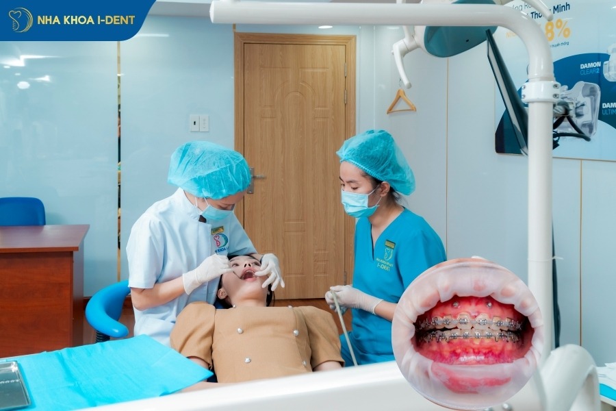 quá trình niềng răng mất bao lâu