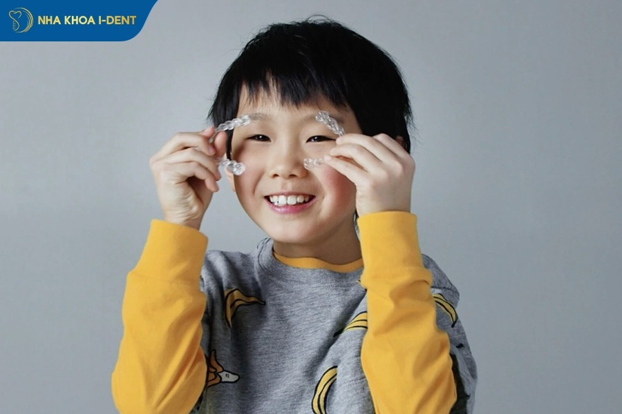 niềng răng khoảng bao lâu