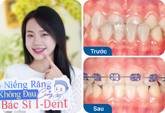 Chị Đỗ Huỳnh Linh Nhi