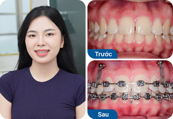 Chị Dương Hoàng Tú Uyên