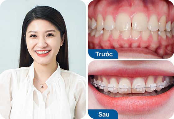 Chị Giang Nguyễn