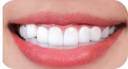 Snaggletooth Style (Charming Canine Look)