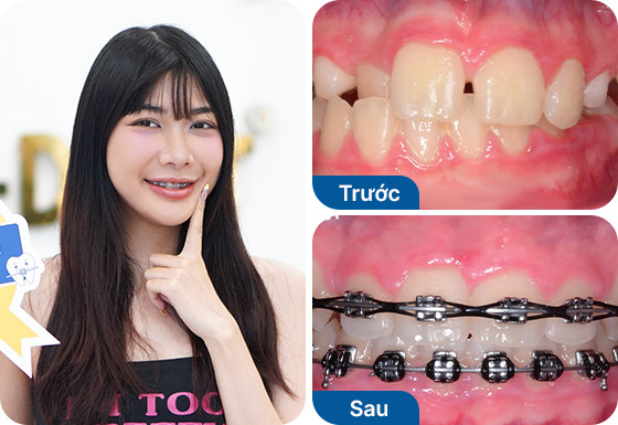 Chị Nguyễn Ngọc