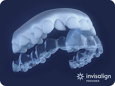 V2 Nieng Nhu Khong Nieng