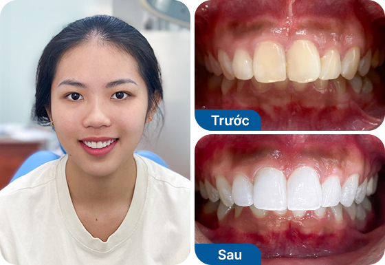 Chị Nguyễn Hữu