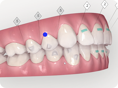 V2 Cong Nghe Invi 7 1